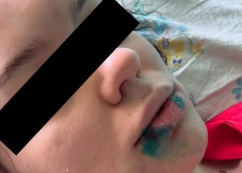 Жительницу Экибастуза избивали больше часа и пытались накачать наркотиками