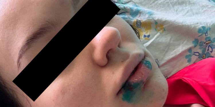 Жительницу Экибастуза избивали больше часа и пытались накачать наркотиками