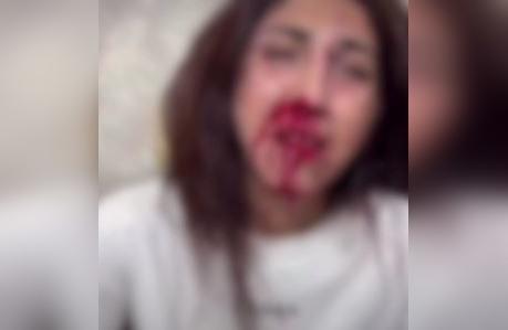 Бывший супруг избил алматинку на глазах у детей (ВИДЕО)