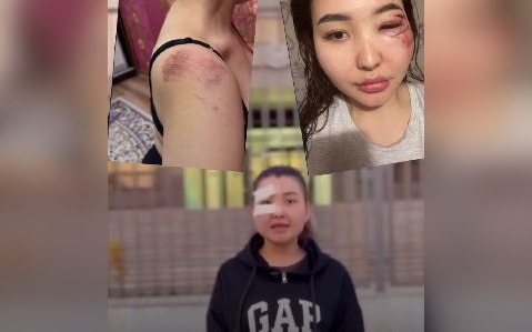 Вывезли на кладбище и избили: блогерша из Атырау стала жертвой нападения (ВИДЕО)