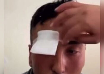 Контрактник лишился глаза во время показательного выступления в Жамбылской области (ВИДЕО)