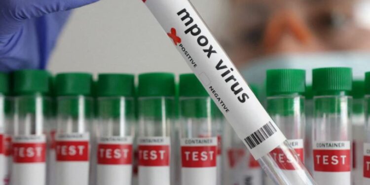 Новый штамм опасного вируса выявлен в Великобритании