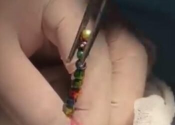 Трехлетний ребенок проглотил 16 магнитов в Шымкенте (ВИДЕО)