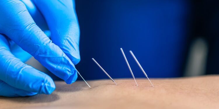 Иглоукалывание обернулось проколом лёгких в ВКО