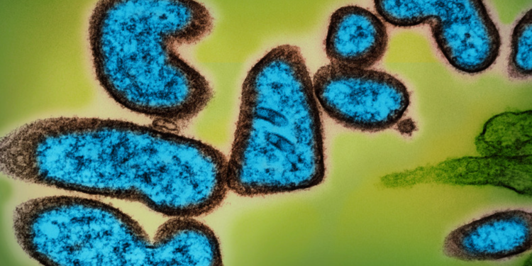 Санврачи предупредили казахстанцев о вирусе Нипах