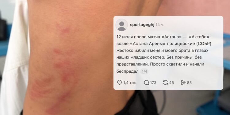 «Били вдевятером руками и ногами»: болельщик обвинил СОБР в избиении после матча в Астане