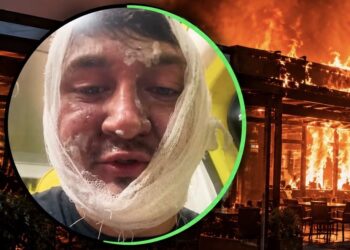 В кафе Астаны произошел взрыв: су-шеф получил тяжелые ожоги